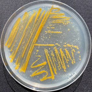 <em>Agarivorans</em> sp. Alg241-V36